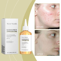 West&Month Moisturizing Toner Gently Cleans Skin From Acne, Moisturizes And Hydrates Refreshing And Moisturizing Toner
