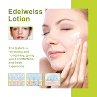 Edelweiss Lotion, Moisturizing And Brightening Face Dull And Shiny Skin Moisturizing Lotion