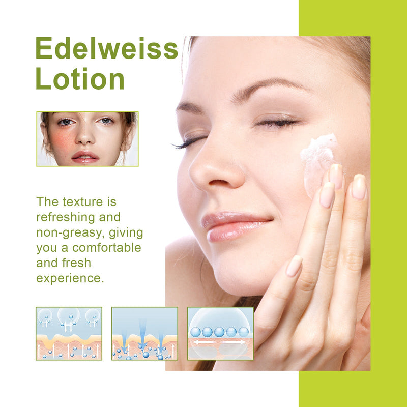 Edelweiss Lotion, Moisturizing And Brightening Face Dull And Shiny Skin Moisturizing Lotion