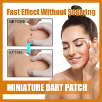 OUHOE Mole Label Repair Patch, Repair Neck Flesh Grain Filamentary Wart Corns Skin Cleaning Gram Wart Patch