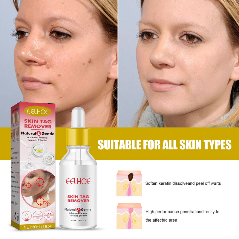 EELHOE Wart Essence Removes Dark Moles Flesh Moles Repair Skin Neck Flesh Grains Flat Especially Corns Remove Warts