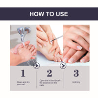 OUHOE Nail Repair Essence, Soft Nail Thickening Nails Smooth Ingrown Toenails Grey Nails Repair Essence