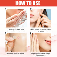 EELHOE Hydrocolloid Acne Patch Face Invisible Makeup Closed Mouth Acne Clear Acne Waterproof Breathable Facial Treatment