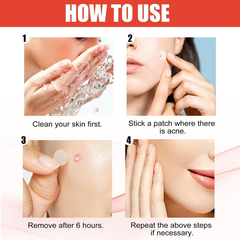 EELHOE Hydrocolloid Acne Patch Face Invisible Makeup Closed Mouth Acne Clear Acne Waterproof Breathable Facial Treatment