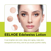 Edelweiss Lotion, Moisturizing And Brightening Face Dull And Shiny Skin Moisturizing Lotion