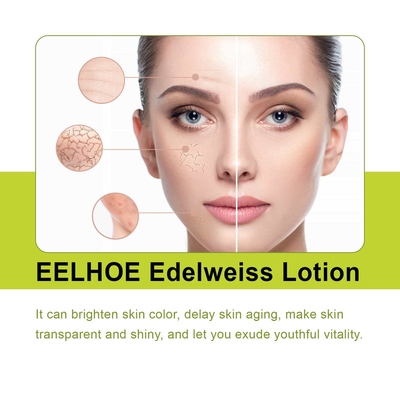 Edelweiss Lotion, Moisturizing And Brightening Face Dull And Shiny Skin Moisturizing Lotion