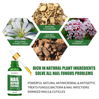 West&Month Nail Repair Essence, Hand And Foot Thickening Brightening Nails Repair Rotten Nails Bad Nails Remove Ash Nail Infection Clean