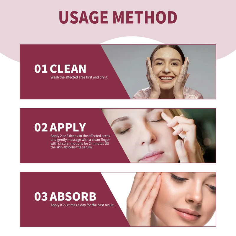 Eye Swelling Soothing Serum, Relieve Redness And Swelling Around The Eyes Moisturizing Essence