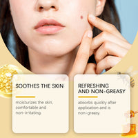 Ximonth Bee Venom Keyo Ointment, Gently Cleans Body Skin And Moisturizes Skin Moles With Bee Venom Essence