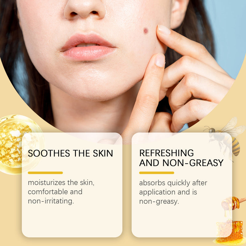 Ximonth Bee Venom Keyo Ointment, Gently Cleans Body Skin And Moisturizes Skin Moles With Bee Venom Essence