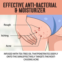West&Month Buttock Care Cream, Repair Rough Buttock Skin Gentle Care Moisturizing And Moisturizing Skin