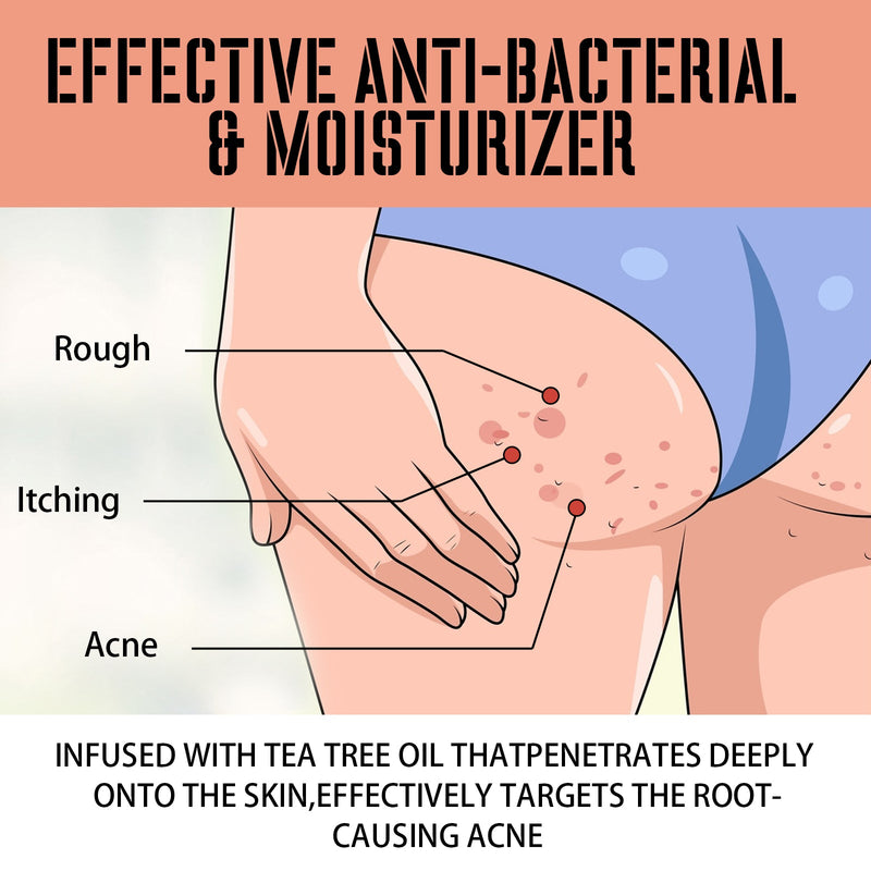 West&Month Buttock Care Cream, Repair Rough Buttock Skin Gentle Care Moisturizing And Moisturizing Skin