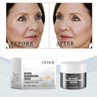 OUHOE Retinol Cream, Improves Skin Elasticity, Hydrates, Nourishes And Nourishes Delicate Skin Care Cream