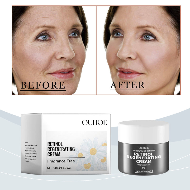 OUHOE Retinol Cream, Improves Skin Elasticity, Hydrates, Nourishes And Nourishes Delicate Skin Care Cream