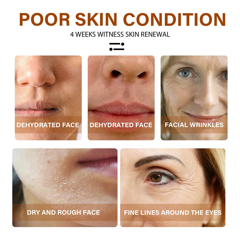 Retinol Face Essence Gently Moisturizes, Replenishes Moisture, Closes Pores And Equalizes Face Essence