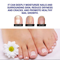 Plant Drops, Repair Extremities Soft Thickening Light Armour Moist Clean Fingernails Detailer