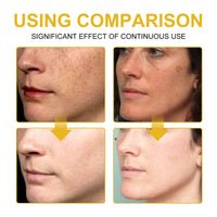 V7 Whitening Cream Reduces Wrinkles And Fine Lines On The Face, Moisturizes And Brightens Skin, Anti-Aging And Replenishing Cream