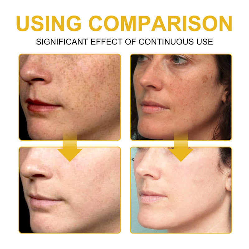 V7 Whitening Cream Reduces Wrinkles And Fine Lines On The Face, Moisturizes And Brightens Skin, Anti-Aging And Replenishing Cream