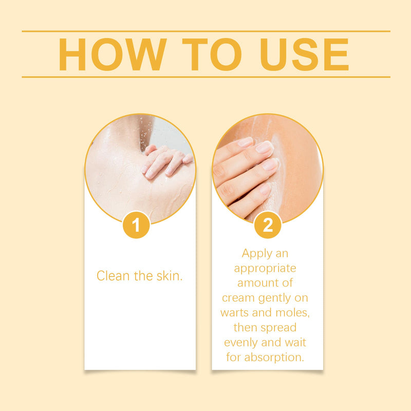 Ximonth Mole Removal Cream, A Gentle Herbal Cleanser And Mole Removal Repair Moisturizing Body Care Cream