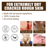 South Moon Cracked Heel Care Cream, Repair Foot Anti-Cracking, Peeling And Chapping Moisturizing Foot Cream