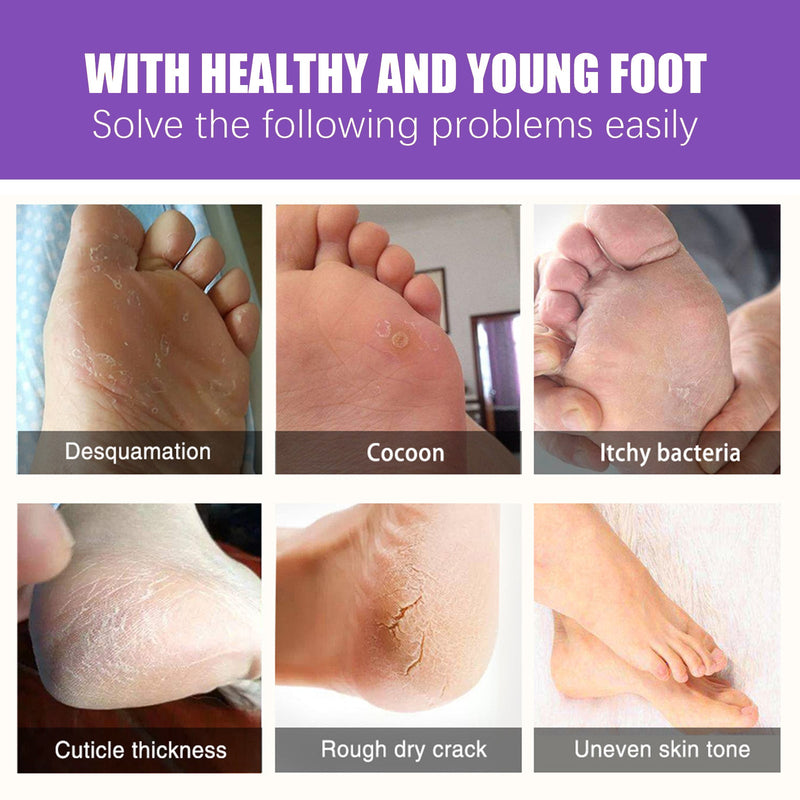 EELHOE Ginger Foot Mask (Box) Foot Moisturizing, Nourishing, Rejuvenating, Exfoliating, Removing Dead Skin, Dry And Cracked Skin Care Foot Mask