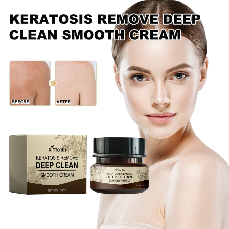 Keratosis Remove Deep Clean Smooth Cream, Clear Skin Acne Exfoliating Unclog Pores Moisturizing Tender And Smooth Skin