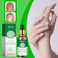 Grey Nail Repair Solution For Hands, Feet, Nails, Soft Nails, Thick Toes And Damaged Nails