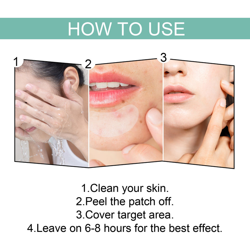 EELHOE Acne Patch Mild Non-Irritating Facial Pores Skin Cleansing Comfort Patch