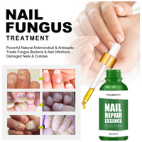 West&Month Nail Repair Essence, Hand And Foot Thickening Brightening Nails Repair Rotten Nails Bad Nails Remove Ash Nail Infection Clean