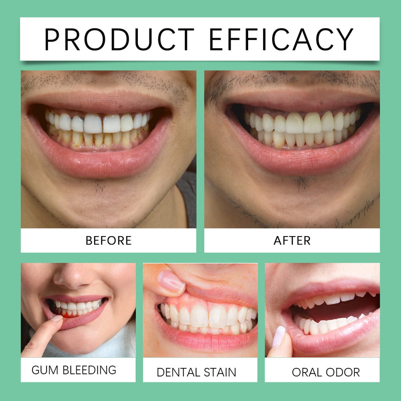 Oral Gums Mild Care Gel, Gentle Gum Care Gel Highly Effective Soothing Formula To Repair Gums And Improve Oral Health