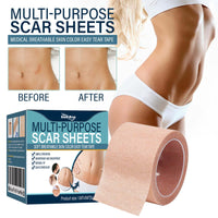 South moon Birthmark Skin Tone Concealer, Cover Body Scars Tattoo Spots Waterproof Color Masking Tape