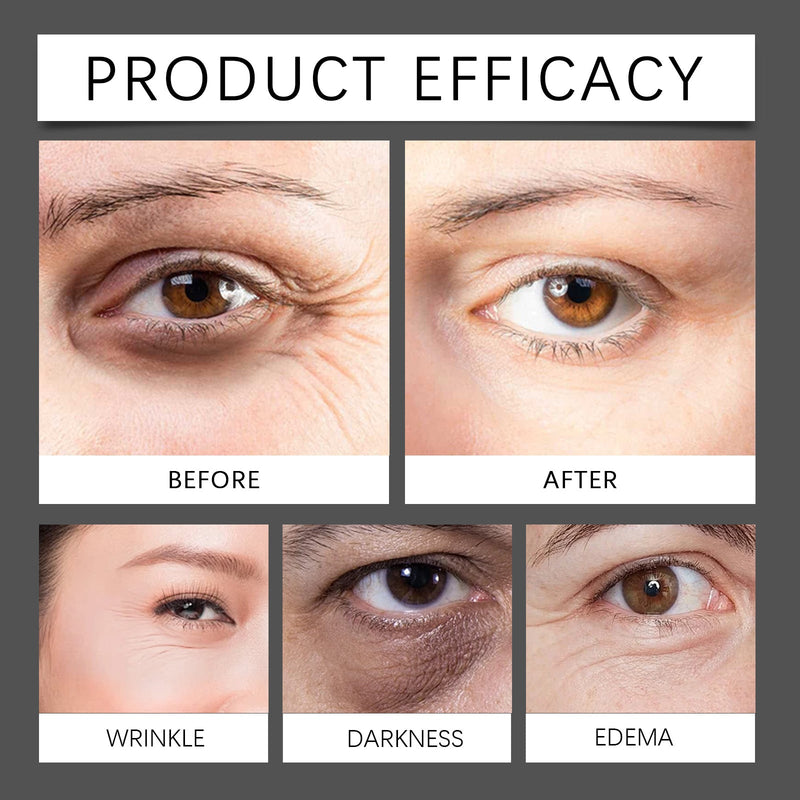 Micro-Minerals Eye Fat Diminishing Cream, Eye To Butter Cream Moisturizing Anti-Wrinkle Bust Firming Moisturizing Eye Creams