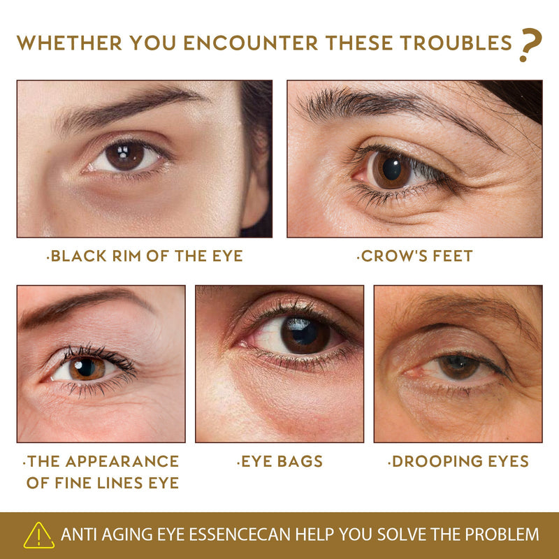 Anti-Aging Eye Serum, Eye Bags, Pores, Eyes, Fine Lines And Dark Circles Care Essence