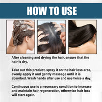 OUHOE Hair Essence Spray, Prevent Hair Loss Repair Hair Dry And Frizzy Moisture And Dense Hair Essence
