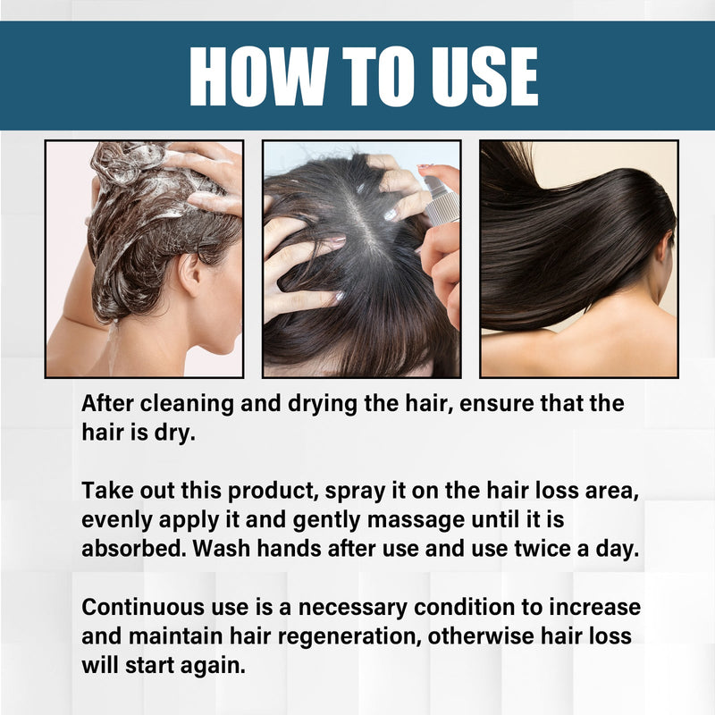 OUHOE Hair Essence Spray, Prevent Hair Loss Repair Hair Dry And Frizzy Moisture And Dense Hair Essence