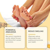 Bee Venom Treatment Cream, Foot Joint Correction Thumb Valgus Swelling Bunion Care Cream