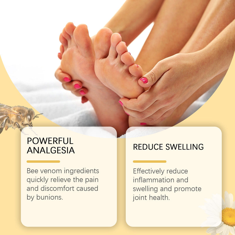 Bee Venom Treatment Cream, Foot Joint Correction Thumb Valgus Swelling Bunion Care Cream