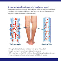 OUHOE Intravenous Spray, Relief Of Varicose Blood Vessel Bulge Pain Intravenous Massage Treatment Spray