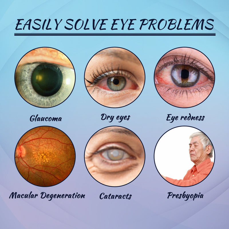 EELHOE Lubricant Eye Drops, Relieve Redness Eye Fatigue Dryness Blurred Vision And Moisturize Eye Care Solution