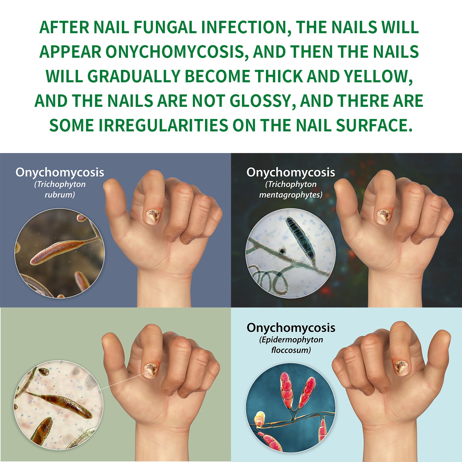 Ginger Nail Care Solution, Repair Hand, Foot And Nail Care Soft Nail Shine Moisturizer Gray Nails