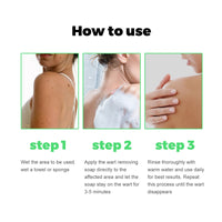 South Moon Skin Tag Removal Rubber Band, Remove Moles Remove Warts Face Neck Flesh Granule Body Cleansing Soap