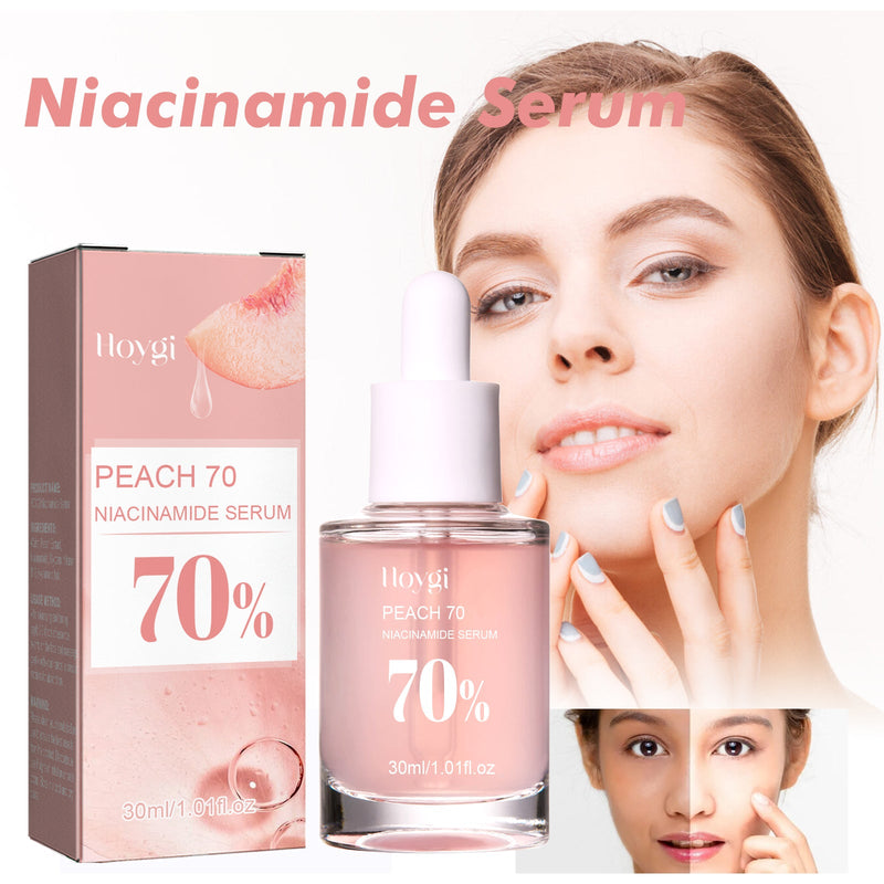 Hoygi Nicotinamide Essence Tights And Moisturizes Pores, Lighens Acne Marks And Spots, Moisturizes And Brighens Skin