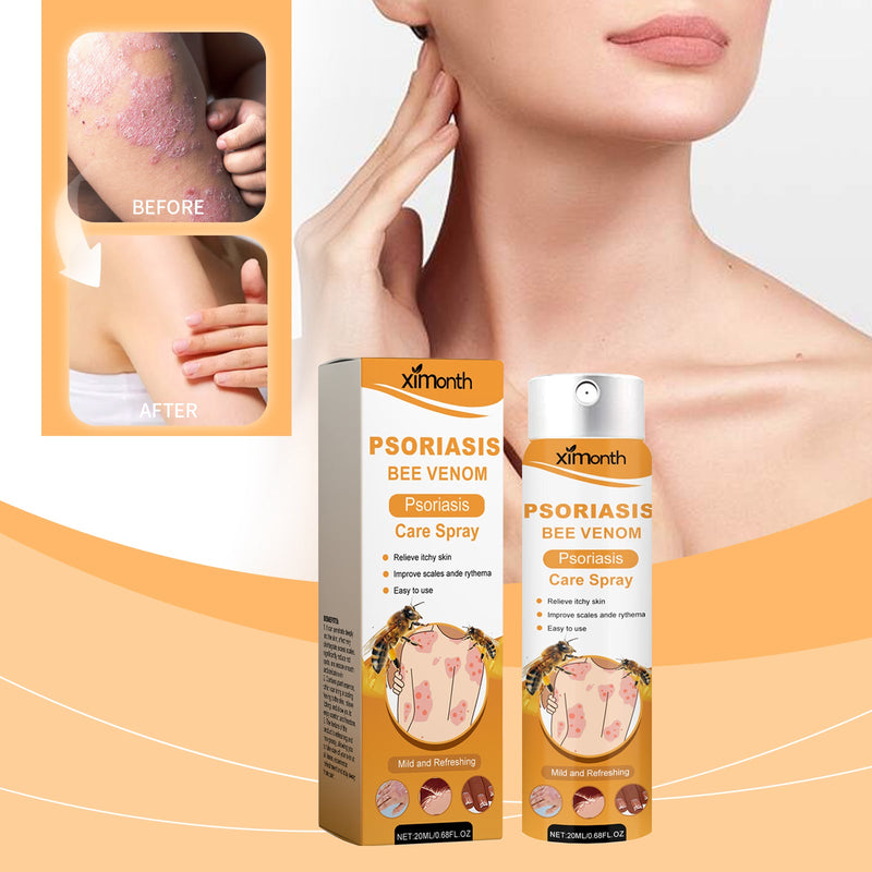 Bee Venom Psoriasis Care Spray, Psoriasis Spray Herbal Cooling Anti-Itch Skin Care Anti-Dandruff Light Redness Spray