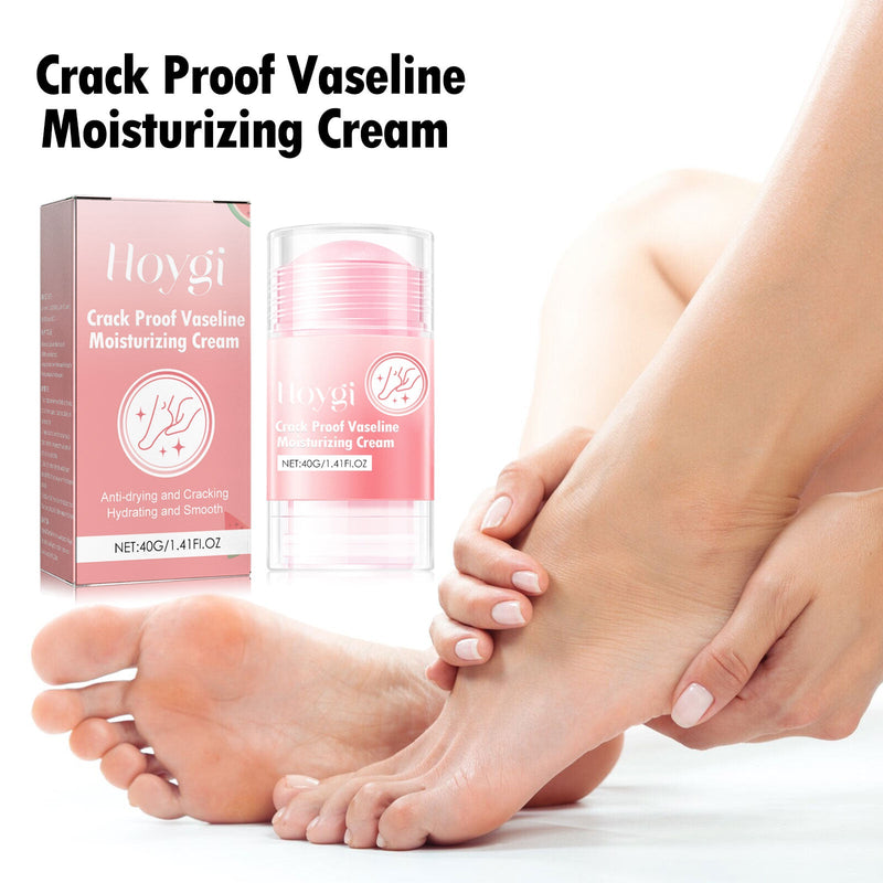Anti-Crack Hand And Foot Moisturizer, Foot Care Anti-Crack And Dead Skin, Hand And Foot Skin Moisturizer