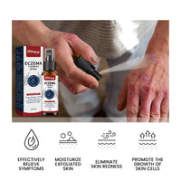 South Moon Eczema Therapy Spray, Repair Skin Redness And Itchiness Cowskin Moss Care Spray