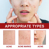 Facial Care Acne Patch, Gently Clean And Reduce Acne Skin Soft Smooth Multi-Shape Portable Acne Patch