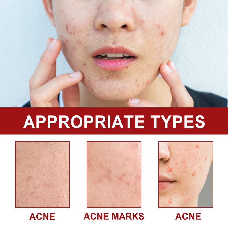 Facial Care Acne Patch, Gently Clean And Reduce Acne Skin Soft Smooth Multi-Shape Portable Acne Patch