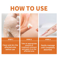 Psoriasis Behandlungscreme, Relieve Hand And Foot Skin Redness, Relieve Itching, Repair And Moisturize Skin Care