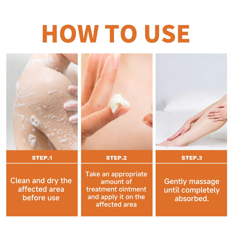 Psoriasis Behandlungscreme, Relieve Hand And Foot Skin Redness, Relieve Itching, Repair And Moisturize Skin Care