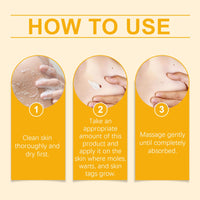 Ximonth Kew Mole Cream Gently Cleanses Skin And Lubrates Rejuvenating Herbal Body Care Cream